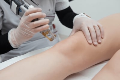 epilation-definitve-paris